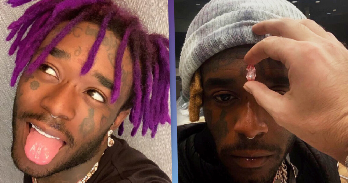 Lil Uzi Vert Reveals The Reason Why He Put A 24 Million Diamond In His Head